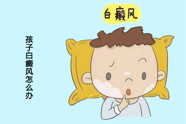 孩子白癜风怎么办